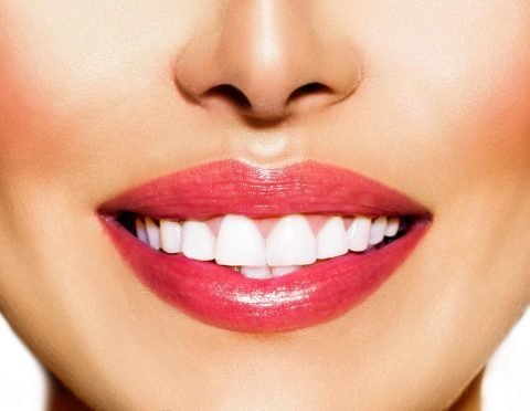 Internal Teeth Bleaching Leederville Dentists On Vincent Leederville