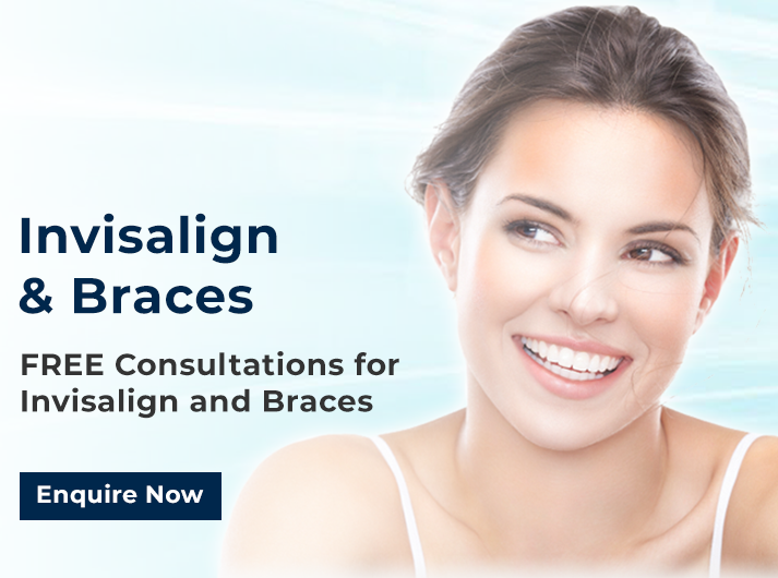 FREE Consultation for Invisalign and Braces
