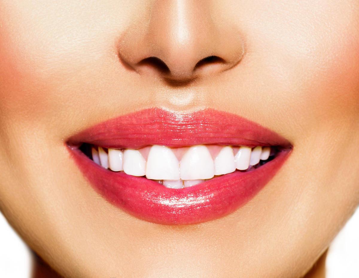 internal teeth bleaching leederville