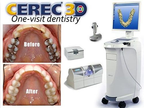 cerec techonology leedeville