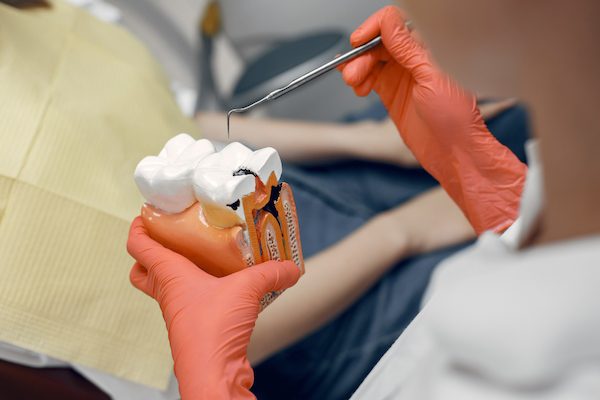 root canal treatment leederville