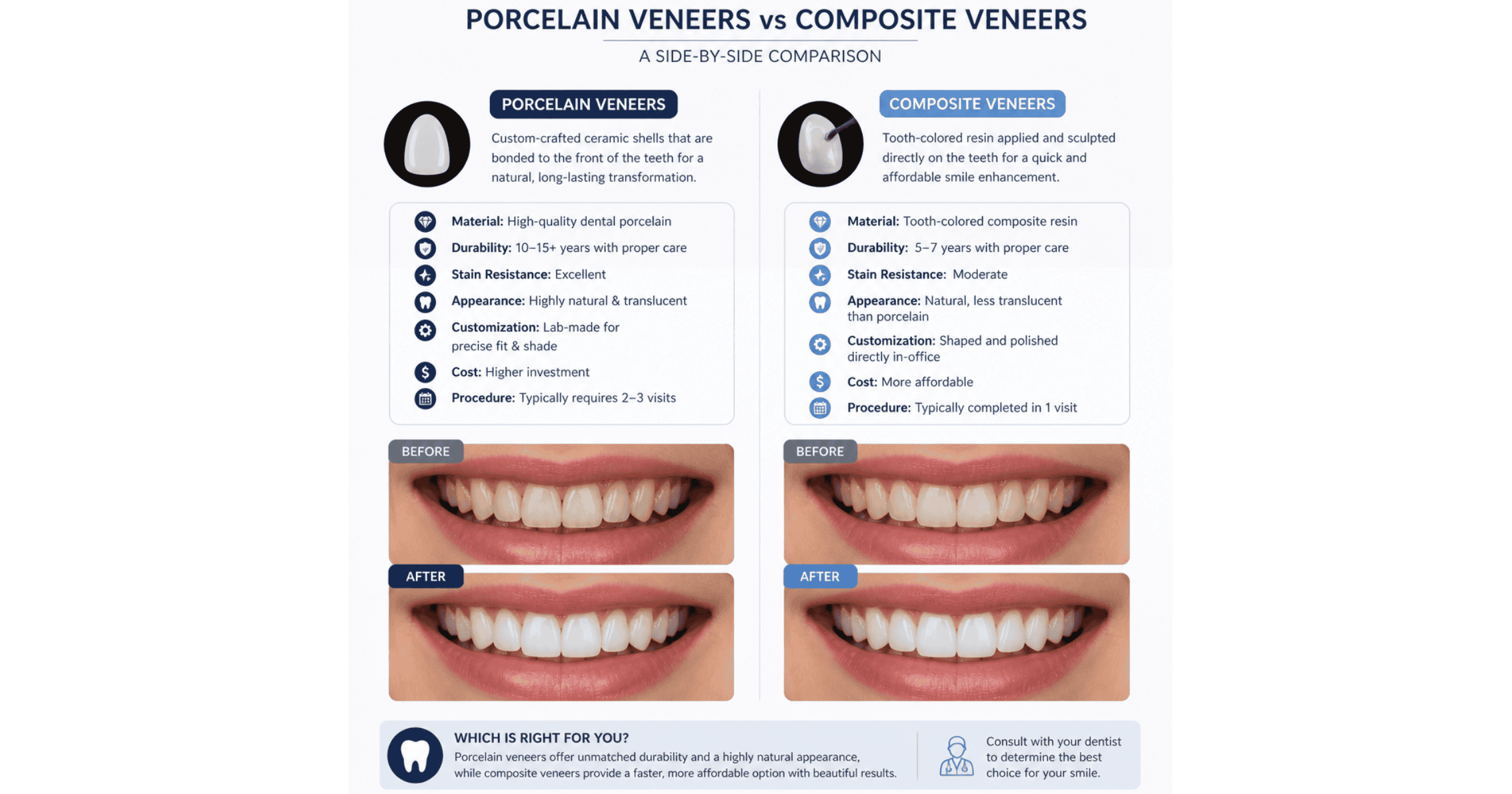 porcelain veneers vs composite veneers comparison in Leederville
