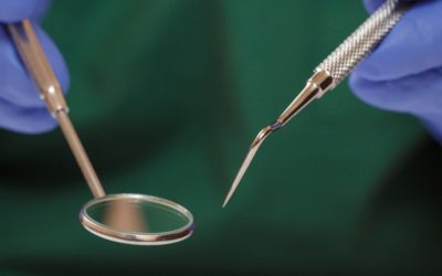 Plaque vs Tartar: The Difference and Why It Matters
